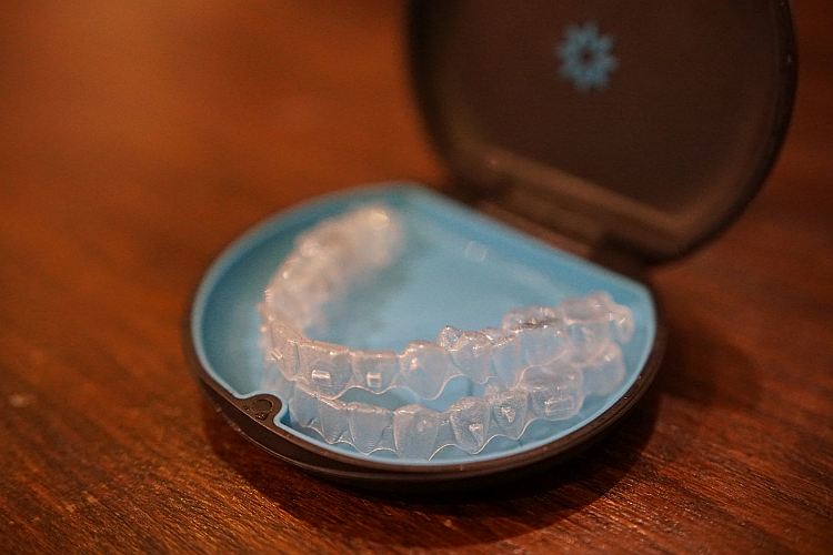 Invisalign beugels